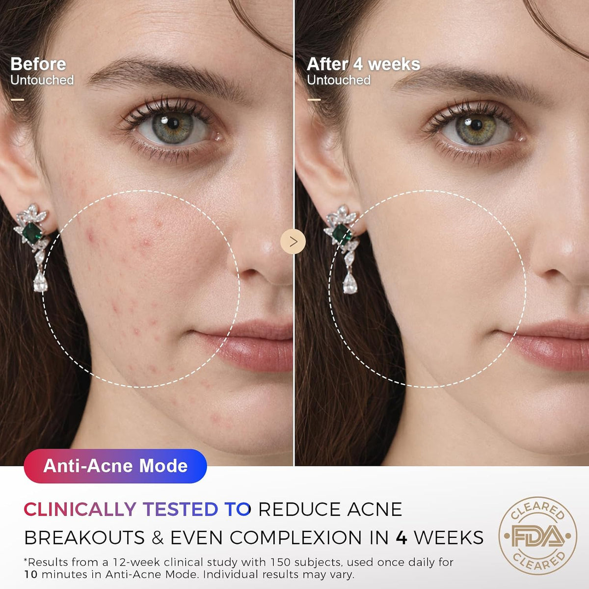 FDA Cleared Red Light Therapy Mask for Face, 850Nm NIR, 320 Leds