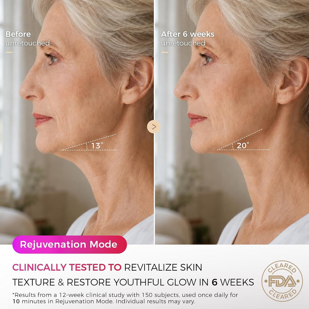 FDA Cleared Red Light Therapy Mask for Face, 850Nm NIR, 320 Leds