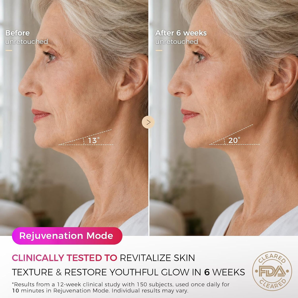 FDA Cleared Red Light Therapy Mask for Face, 850Nm NIR, 320 Leds