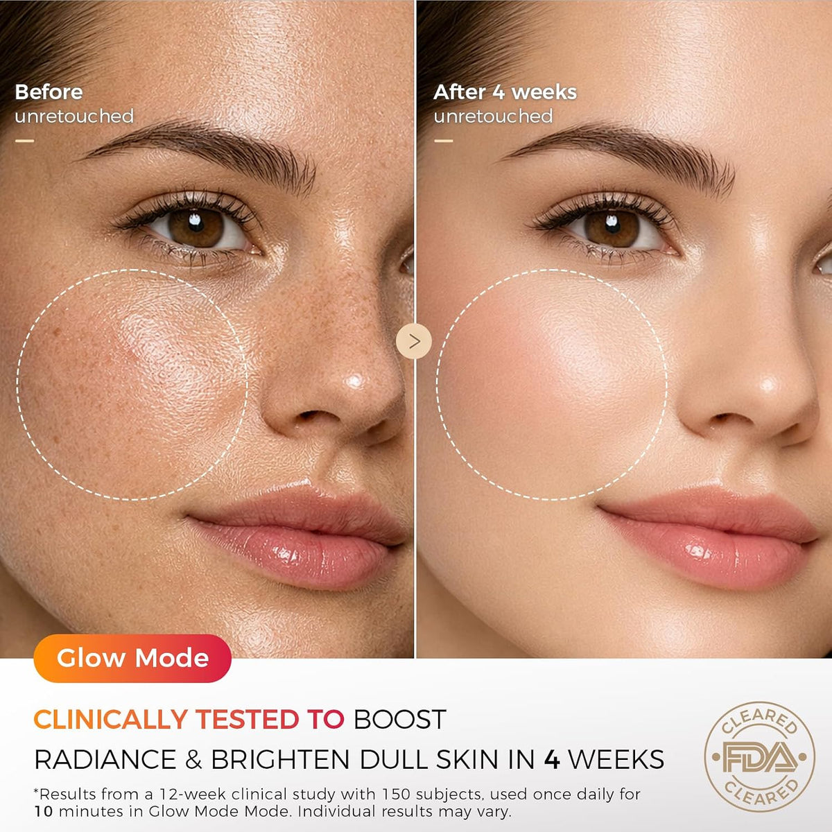 FDA Cleared Red Light Therapy Mask for Face, 850Nm NIR, 320 Leds
